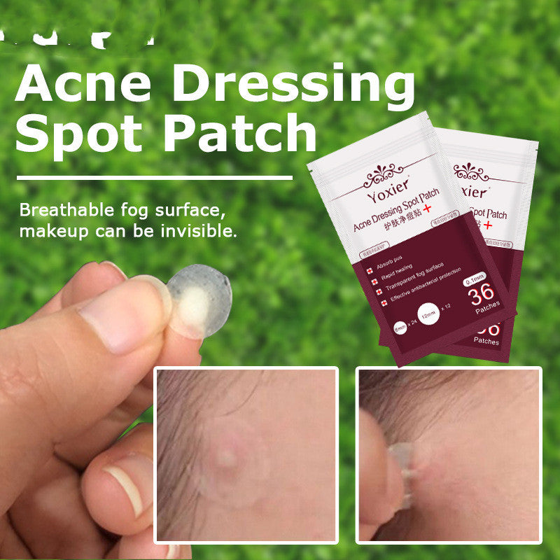 Skin Care Tools Acne Dressing Spot Patch Blemish Treatment