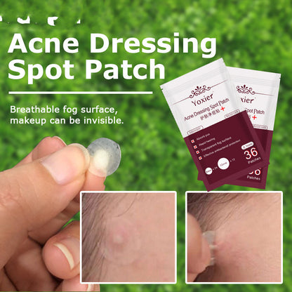 Skin Care Tools Acne Dressing Spot Patch Blemish Treatment
